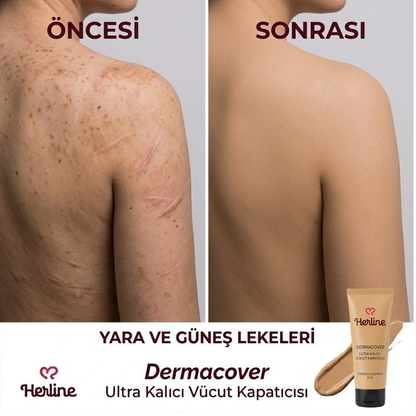 Herline DermaCover Ultra (Kalıcı Vücut Kapatıcısı & Pürüzsüzleştirici Efekt)