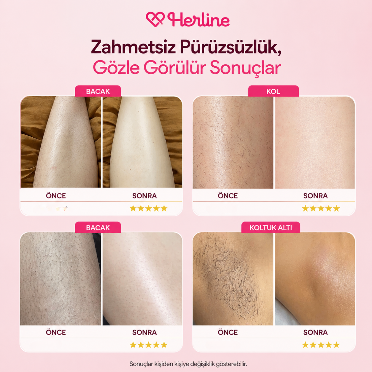 Herline SmoothTrim 2'si 1 Arada Tıraş Makinası