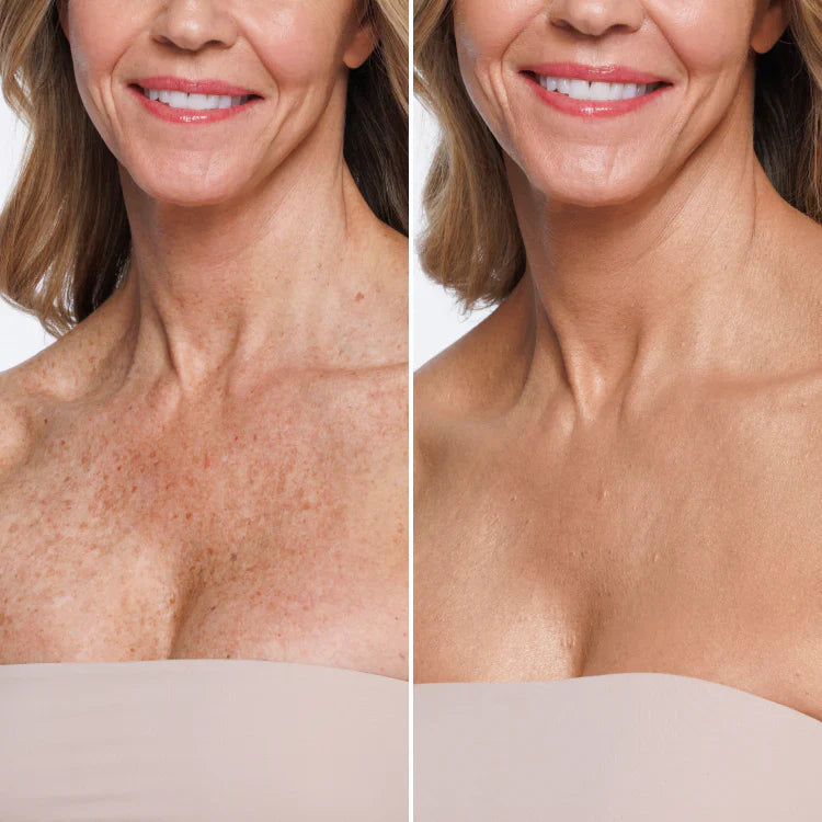 Herline DermaCover Ultra (Kalıcı Vücut Kapatıcısı & Pürüzsüzleştirici Efekt)
