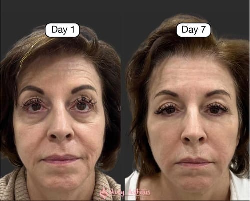 Herline SculptBrush™ – Yüz Şekillendirici Masaj Fırçası