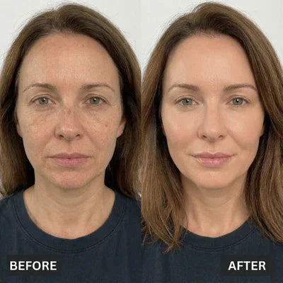 Herline SculptBrush™ – Yüz Şekillendirici Masaj Fırçası